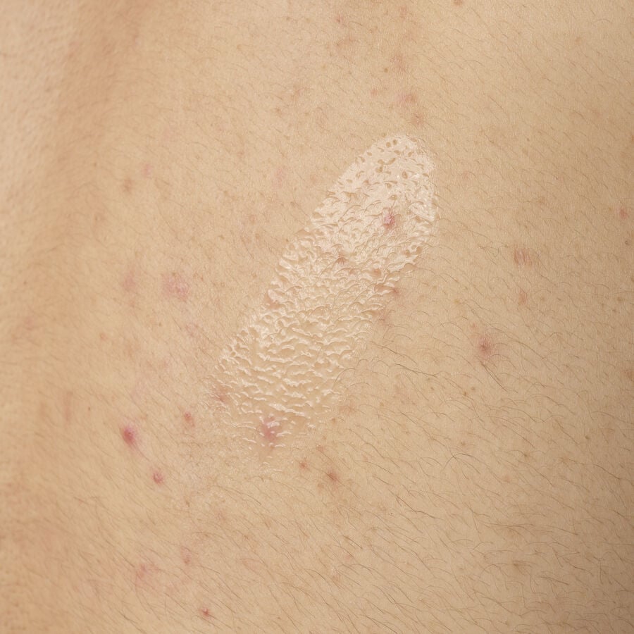 Salicylic Acid 0.5% Body Serum - US 4342