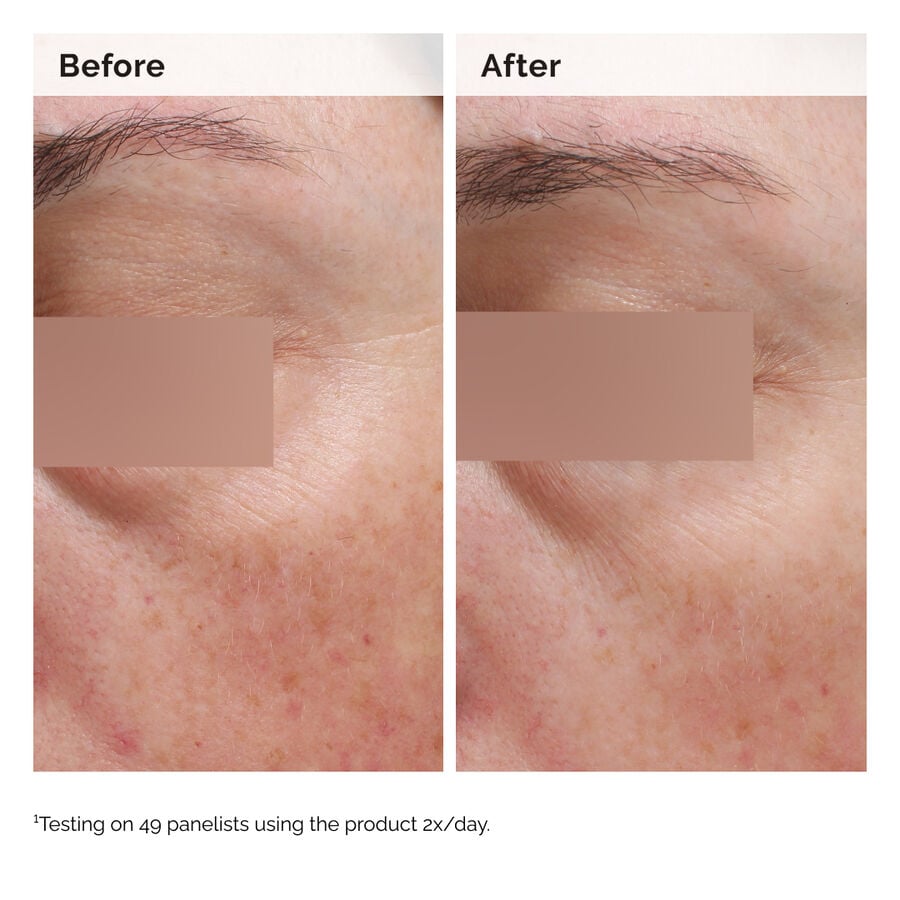 Niacinamide 5% Face and Body Emulsion - US 4877