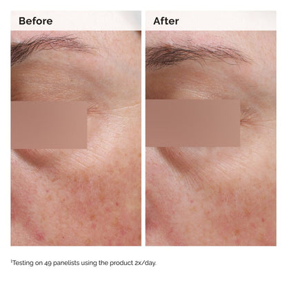 Niacinamide 5% Face and Body Emulsion - US 4877