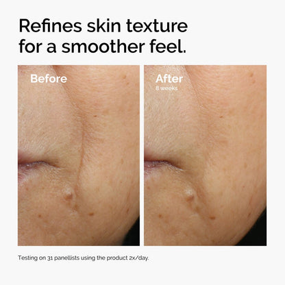 Caffeine 3% + Escin 1% Face Serum - US 8382