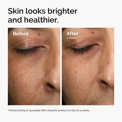 Multi-Antioxidant Radiance Serum - US 5990