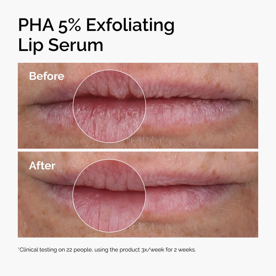 PHA 5% Exfoliating Lip Serum - US 4419