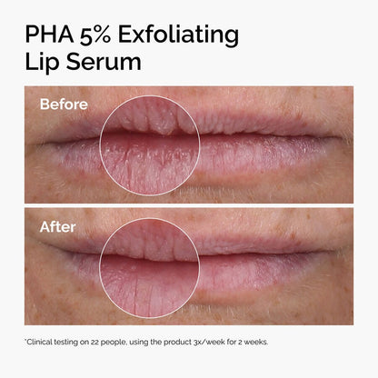 PHA 5% Exfoliating Lip Serum - US 4419